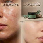 Argile verte Najel - avant/après masque purifiant pour peau grasse et imperfections
