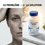 Collagène marin MERalia avant après : problème peau vieillie et solution avec gélules
