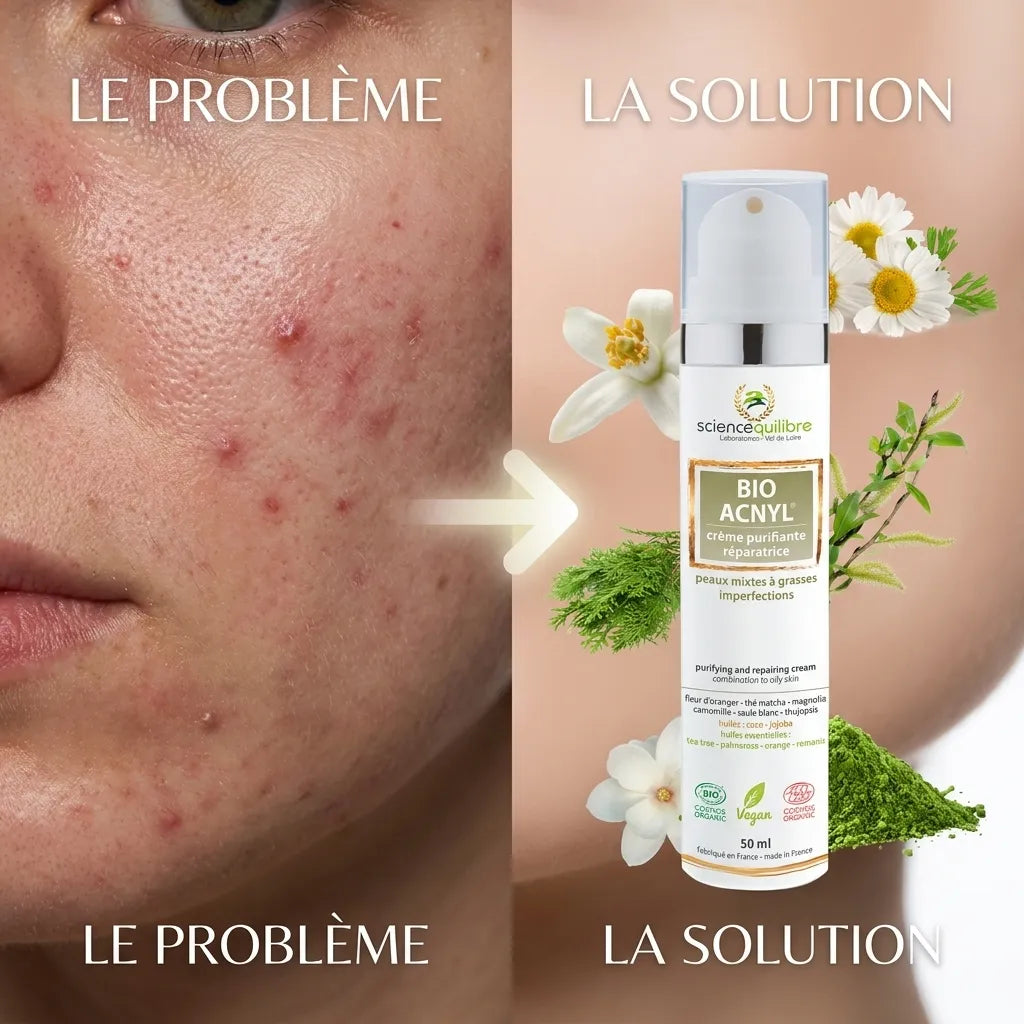 Crème BIO ACNYL avant-après : peau acnéique vs peau claire avec ingrédients naturels