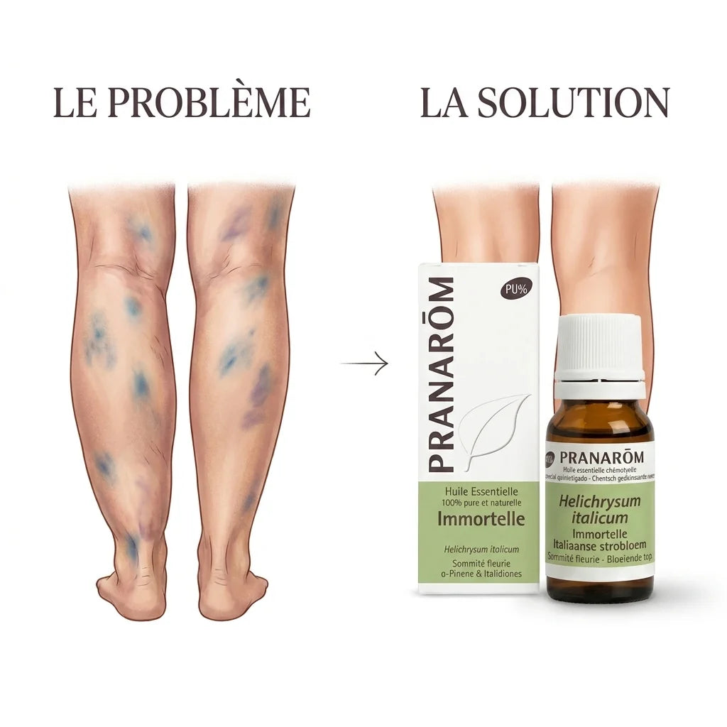 Huile essentielle immortelle Pranarom : solution naturelle jambes lourdes et bleus