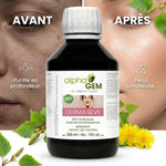 Sève de bouleau Derma-sève Alphagem avant/après : peau purifiée et lumineuse
