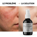 Spray Argent Colloïdal Dr.Theiss 20ppm avant après peau irritée solution naturelle