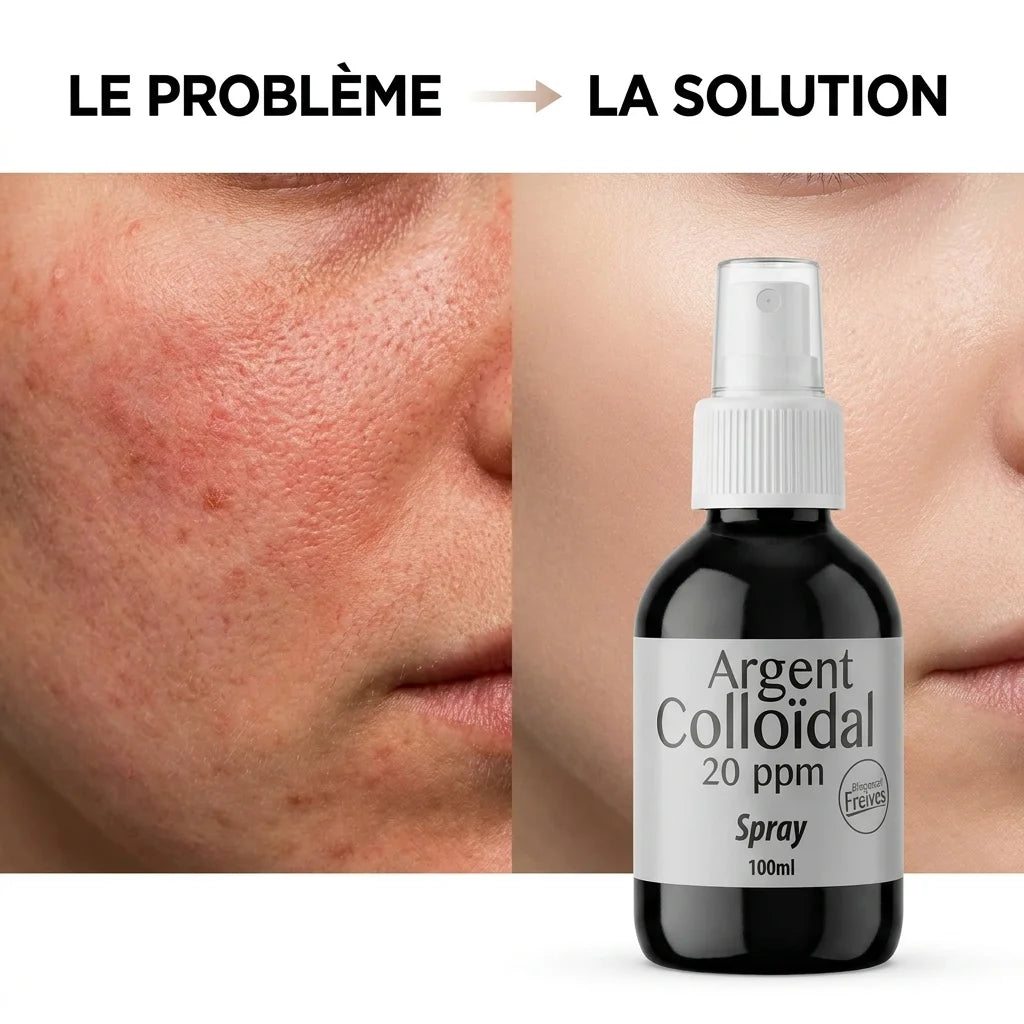 Spray Argent Colloïdal Dr.Theiss 20ppm avant après peau irritée solution naturelle