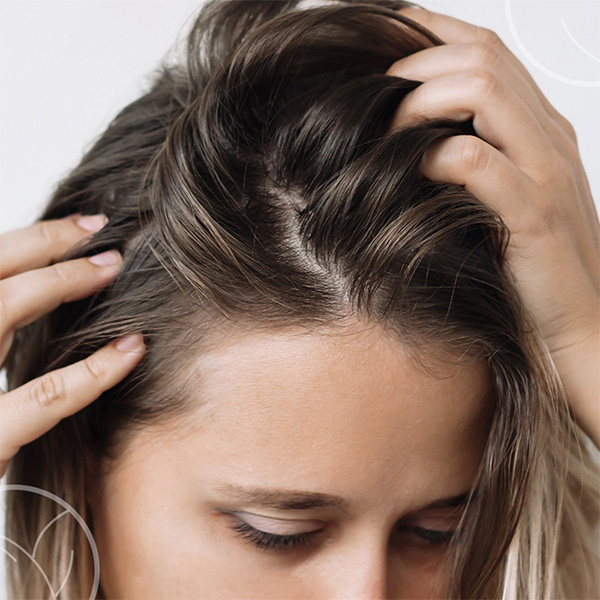 Cheveux d'apparence gras
